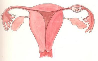 Dính buồng tử cung: Nguyên nhân và cách điều trị tích cực