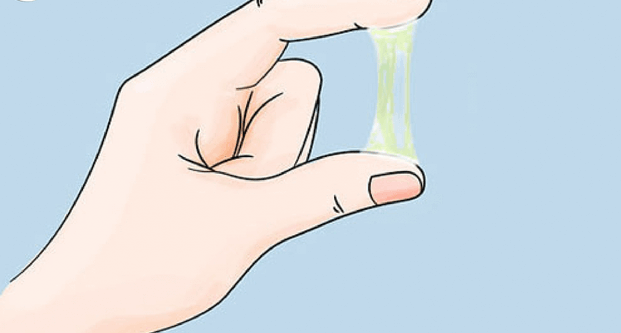 Dấu hiệu viêm cổ tử cung nặng: ra nhiều chất nhầy màu xanh