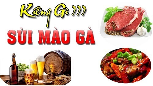 Sùi mào gà kiêng ăn gì?