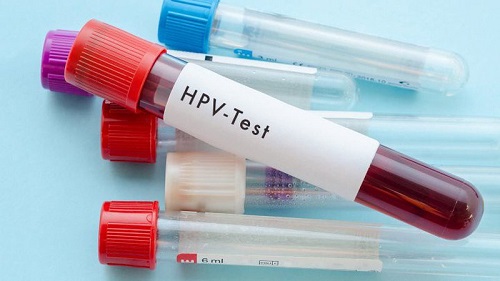 Xét nghiệm virus HPV