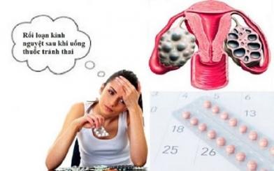 Rối loạn kinh nguyệt sau khi uống thuốc tránh thai có cần phải điều trị?