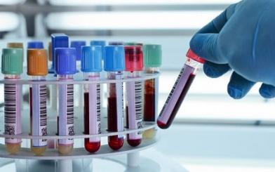 [ Review ] Quy trình xét nghiệm viêm bao quy đầu đúng chuẩn và chính xác