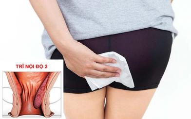 Những loại thuốc chữa trĩ nội độ 2 hiệu quả hiện nay