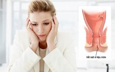 Nứt kẽ hậu môn sau sinh: Nguyên nhân, triệu chứng và cách điều trị hiệu quả