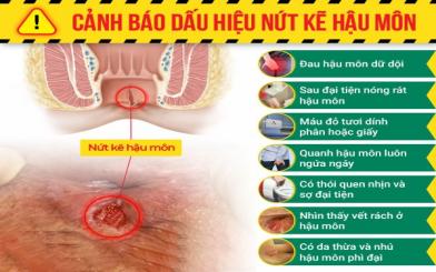 Nứt kẽ hậu môn có gây ung thư không? Giải đáp từ chuyên gia tiêu hóa