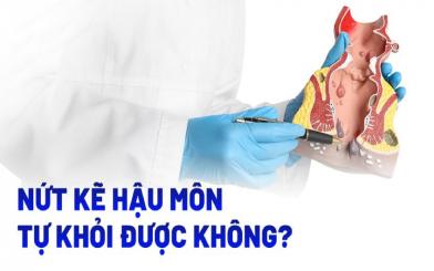 Nứt kẽ hậu môn có tự khỏi được không? Giải đáp từ chuyên gia