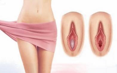 Vá màng trinh có nguy hiểm không? Giải đáp từ bác sĩ chuyên khoa
