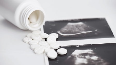 Tìm hiểu về phá thai bằng thuốc 