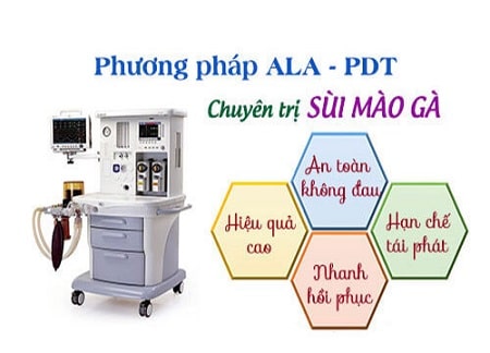 Tìm hiểu về phương pháp ALA - PDT chữa sùi mào gà