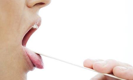 Cách phòng ngừa và điều trị bệnh giang mai ở lưỡi hiệu quả