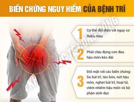 Vì sao không nên trì hoãn điều trị bệnh trĩ ?