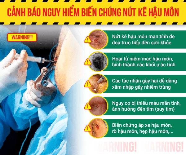 Nứt kẽ hậu môn và những biến chứng nguy hiểm