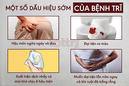 Bạn đã thực sự hiểu rõ về bệnh trĩ chưa?