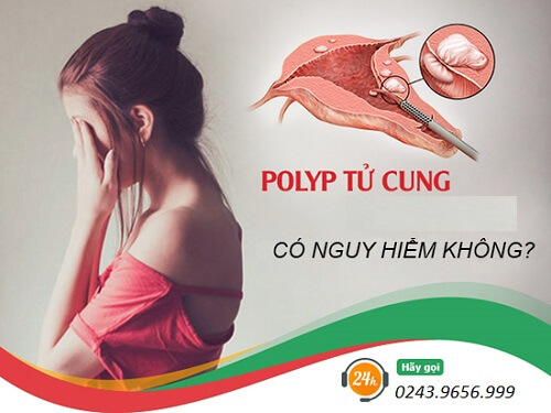 Ra khí hư lẫn tia máu- Dấu hiệu bệnh polyp cổ tử cung