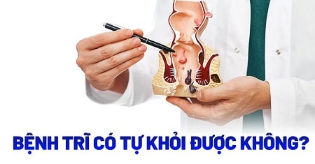 Giải đáp: Trĩ nội có tự hết không?