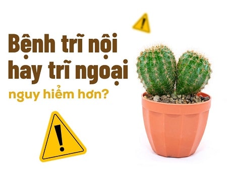 Bác sĩ giải đáp: Trĩ nội hay trĩ ngoại nguy hiểm hơn?