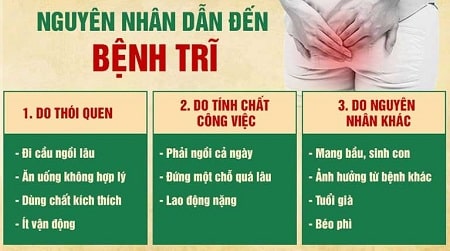 Tìm hiểu nguyên nhân gây bệnh trĩ nội và trĩ ngoại